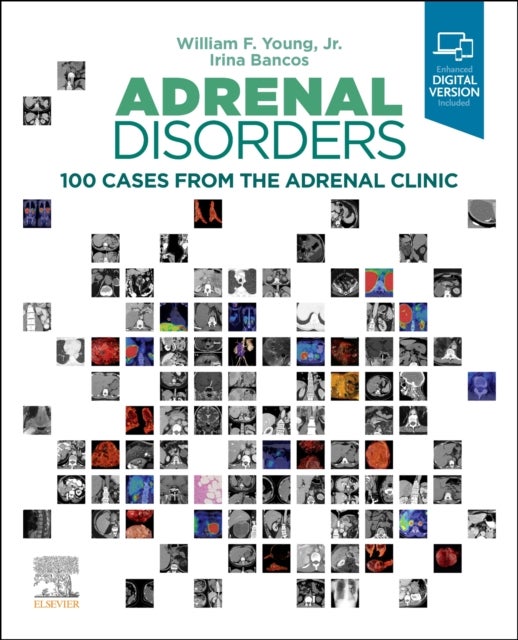 Adrenal Disorders - 100 Cases from the Adrenal Clinic