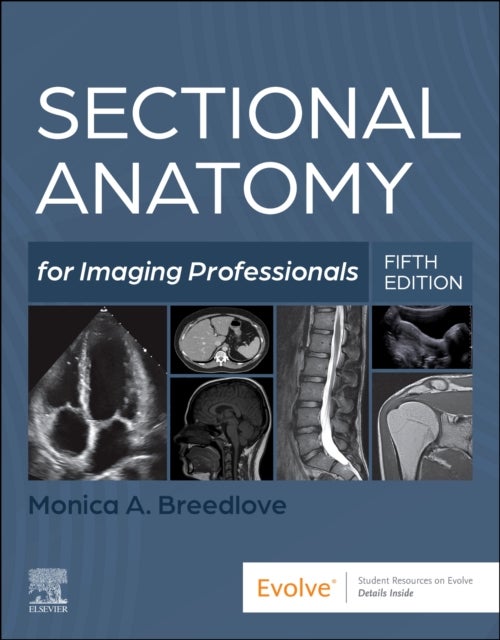Sectional Anatomy for Imaging Professionals
