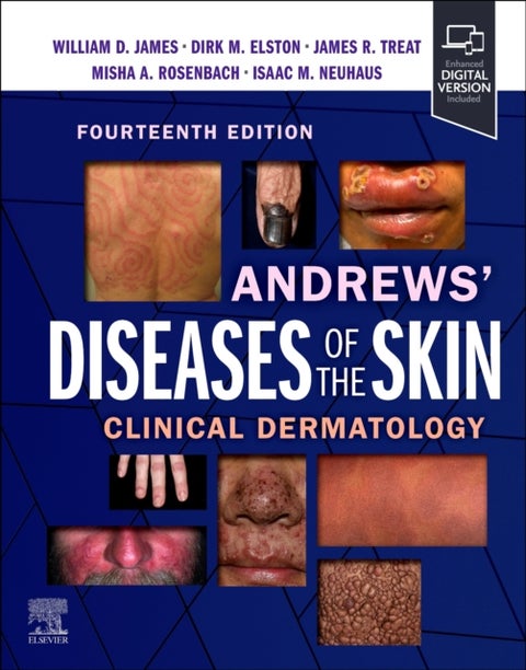 Andrews' Diseases of the Skin - Clinical Dermatology