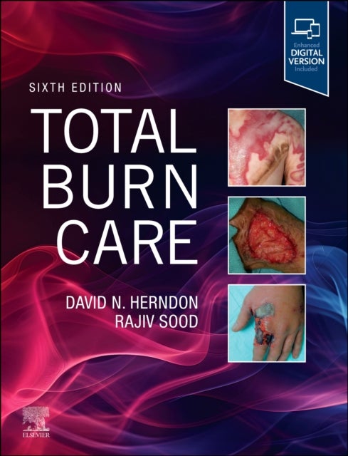 Total Burn Care