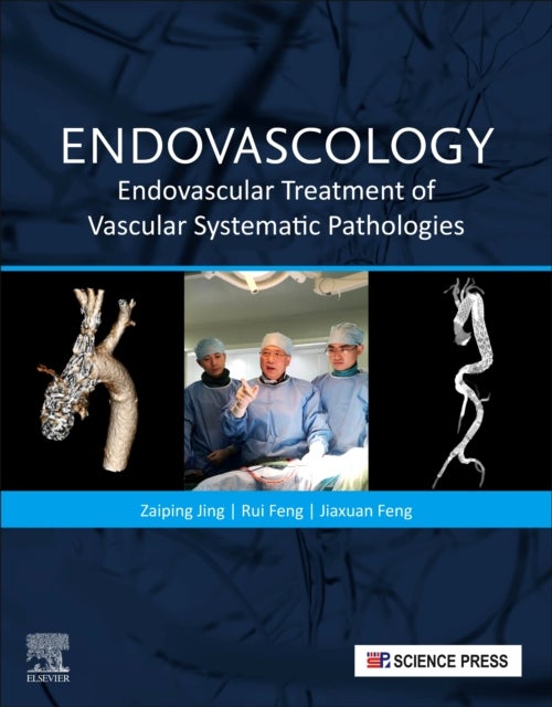Endovascology - Endovascular Treatment of Vascular Systematic Pathologies