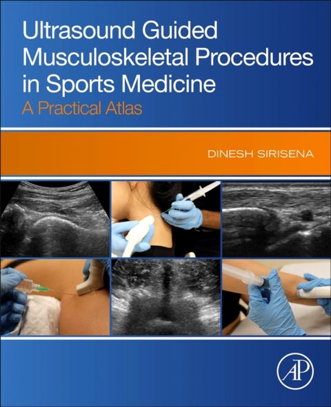 Ultrasound Guided Musculoskeletal Procedures in Sports Medicine - A Practical Atlas