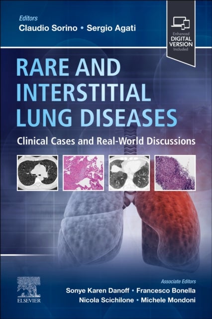 Rare and Interstitial Lung Diseases - Clinical Cases and Real-World Discussions