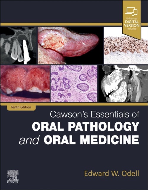 Cawson's Essentials of Oral Pathology and Oral Medicine