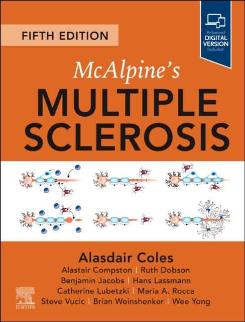 McAlpine's Multiple Sclerosis