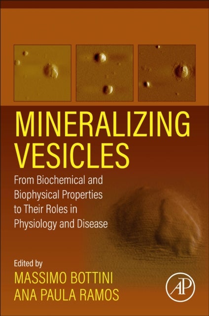 Mineralizing Vesicles - From Biochemical and Biophysical Properties to Their Roles in Physiology and Disease