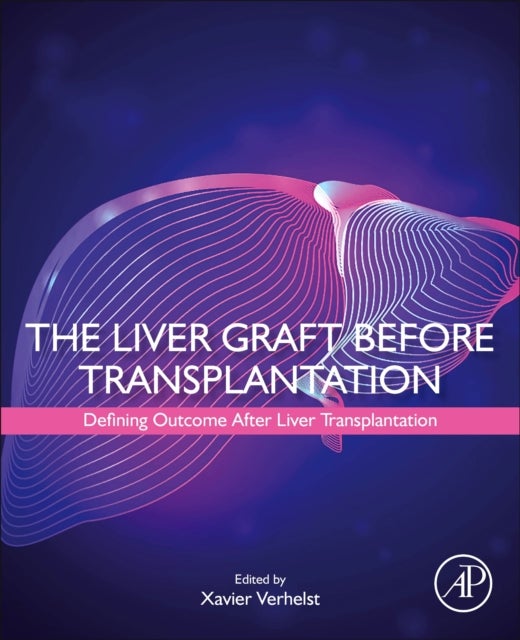 The Liver Graft Before Transplantation - Defining Outcome After Liver Transplantation