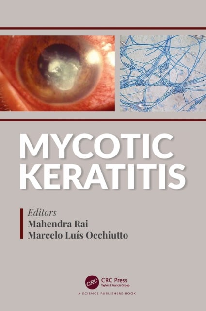 Mycotic Keratitis