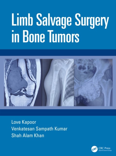 Limb Salvage Surgery in Bone Tumors