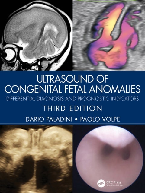 Ultrasound of Congenital Fetal Anomalies - Differential Diagnosis and Prognostic Indicators