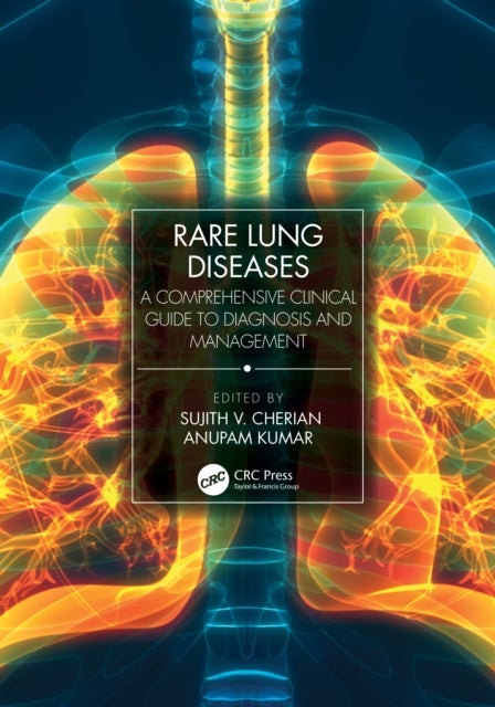Rare Lung Diseases - A Comprehensive Clinical Guide to Diagnosis and Management