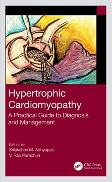 Hypertrophic Cardiomyopathy - A Practical Guide to Diagnosis and Management