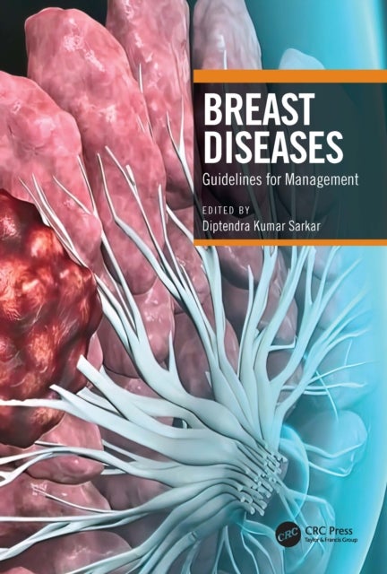 Breast Diseases - Guidelines for Management