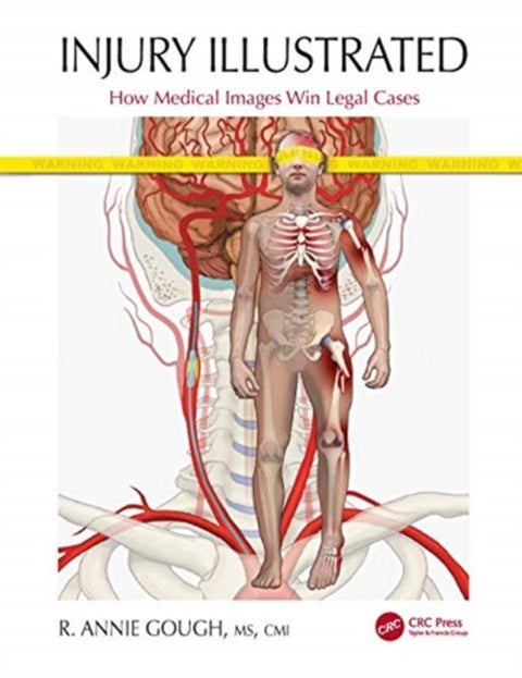 Injury Illustrated - How Medical Images Win Legal Cases