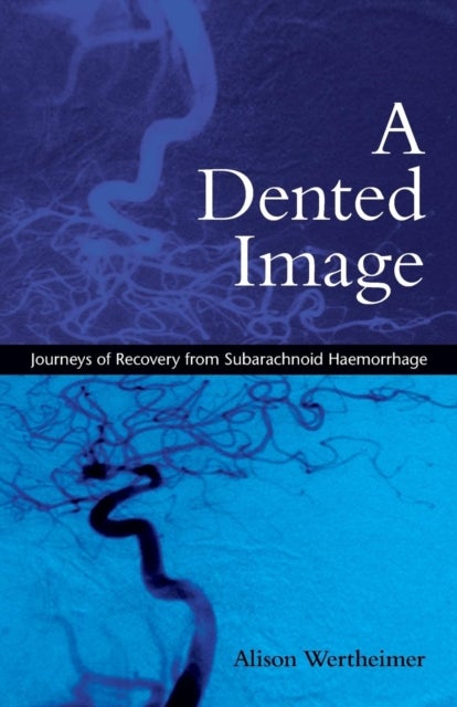 A Dented Image - Journeys of Recovery from Subarachnoid Haemorrhage