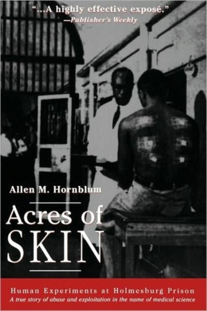 Acres of Skin - Human Experiments at Holmesburg Prison