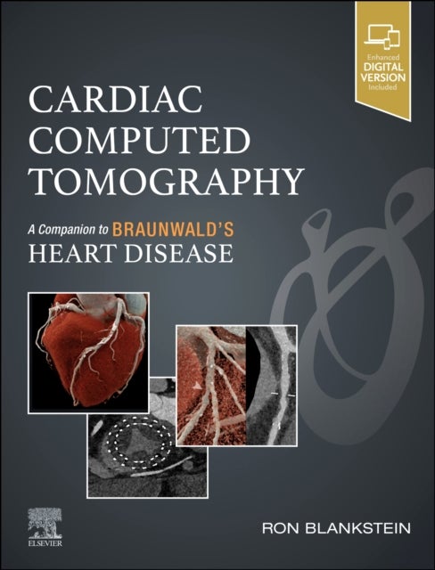 Cardiac Computed Tomography - A Companion to Braunwald's Heart Disease