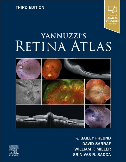 Yannuzzi's Retina Atlas