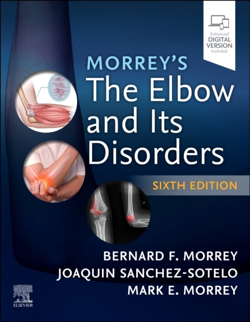 Morrey's The Elbow and Its Disorders