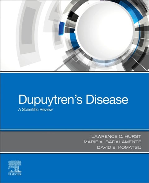 Dupuytren's Disease - A Scientific Review