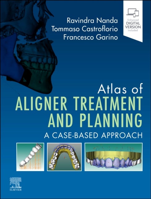 Atlas of Aligner Treatment and Planning - A Case-Based Approach