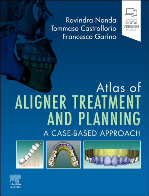 Atlas of Aligner Treatment and Planning - A Case-Based Approach