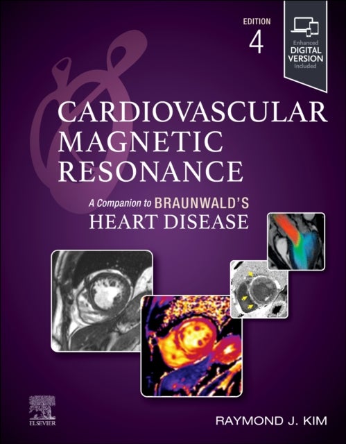 Cardiovascular Magnetic Resonance - A Companion to Braunwald's Heart Disease