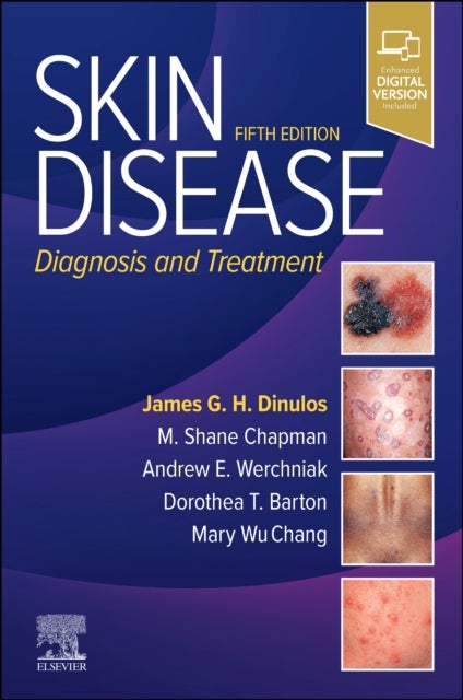 Skin Disease - Diagnosis and Treatment