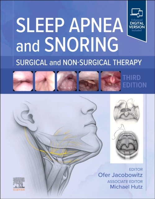 Sleep Apnea and Snoring - Surgical and Non-Surgical Therapy