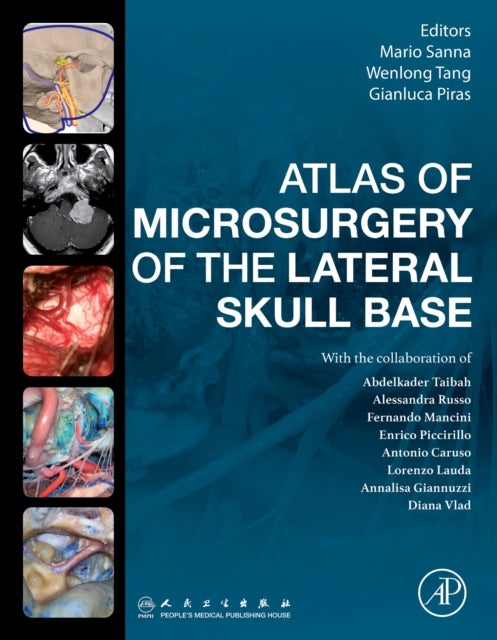 Atlas of Microsurgery of the Lateral Skull Base