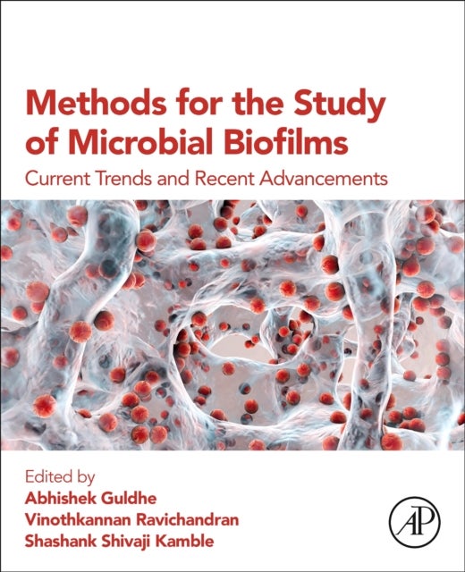 Methods for the Study of Microbial Biofilms - Current Trends and Recent Advancements