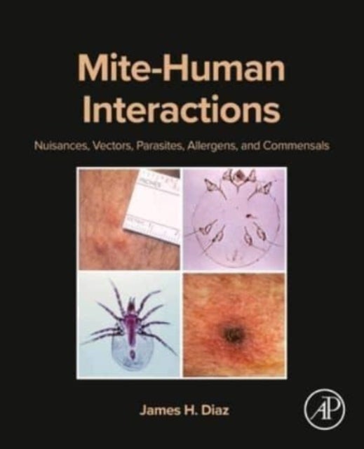 Mite-Human Interactions - Nuisances, Vectors, Parasites, Allergens, and Commensals