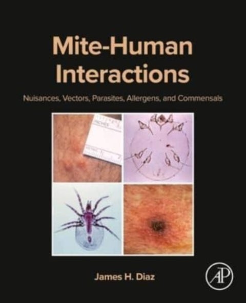 Mite-Human Interactions - Nuisances, Vectors, Parasites, Allergens, and Commensals