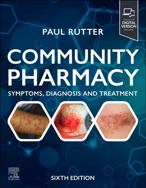 Community Pharmacy: Symptoms, Diagnosis and Treatment - Symptoms, Diagnosis and Treatment