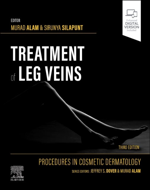 Procedures in Cosmetic Dermatology Series: Treatment of Leg Veins