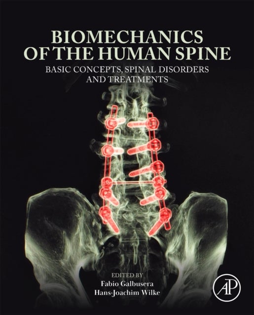 Biomechanics of the Human Spine - Basic Concepts, Spinal Disorders and Treatments