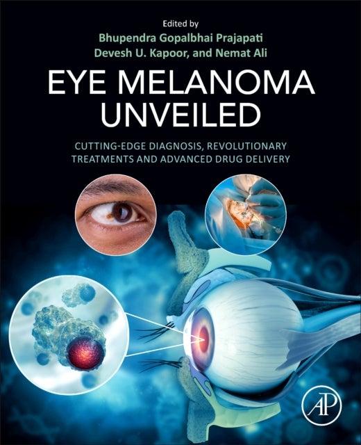Eye Melanoma Unveiled - Cutting-Edge Diagnosis, Revolutionary Treatments and Advanced Drug Delivery