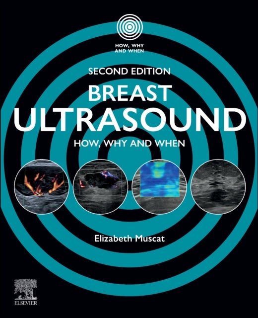 Breast Ultrasound - How, Why and When
