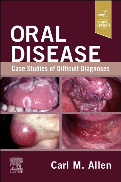 Oral Disease: Case Studies of Difficult Diagnoses - Case Studies of Difficult Diagnoses