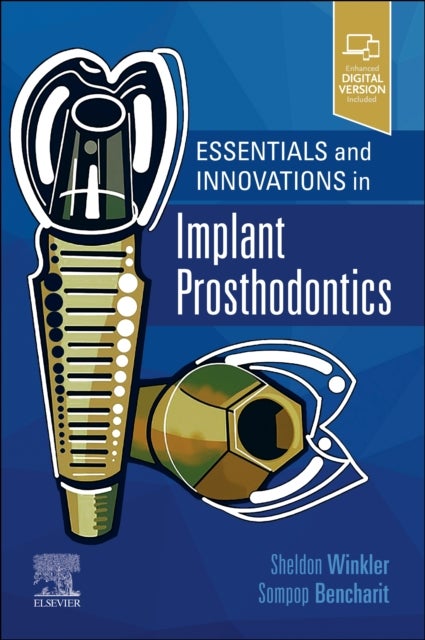 Essentials and Innovations in Implant Prosthodontics