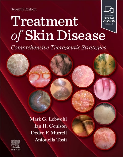 Treatment of Skin Disease: Comprehensive Therapeutic Strategies - Comprehensive Therapeutic Strategies
