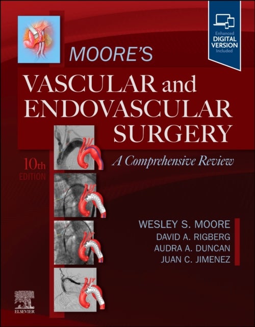 Moore's Vascular and Endovascular Surgery: A Comprehensive Review - A Comprehensive Review