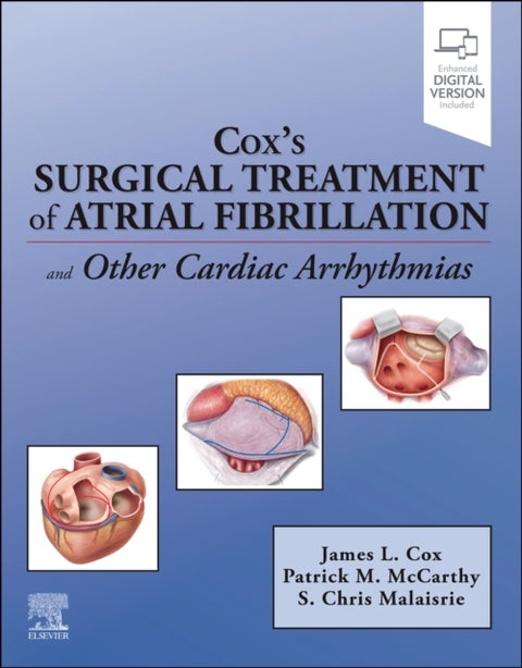 Cox's Surgical Treatment of Atrial Fibrillation