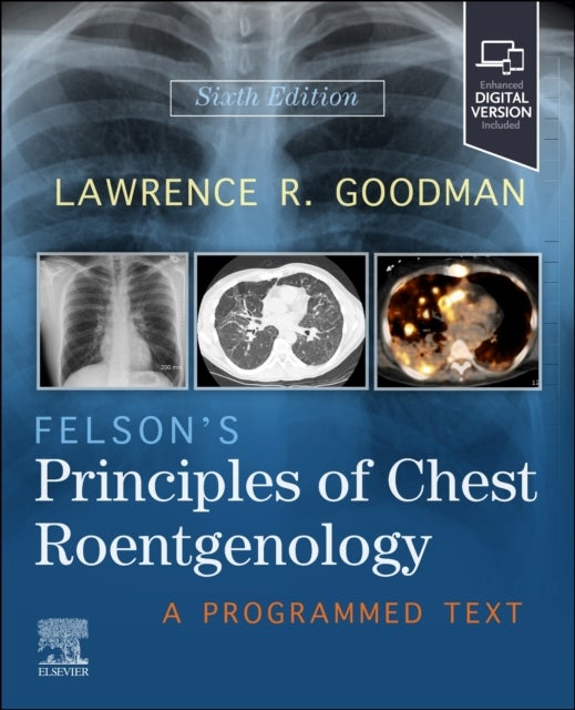 Felson's Principles of Chest Roentgenology - A Programmed Text