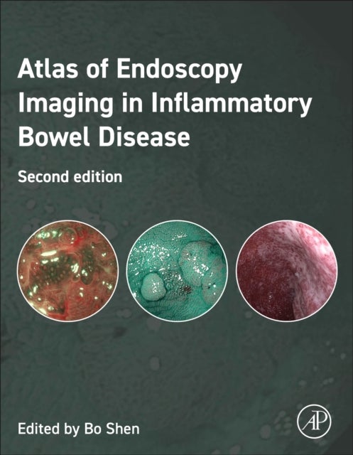 Atlas of Endoscopy Imaging in Inflammatory Bowel Disease