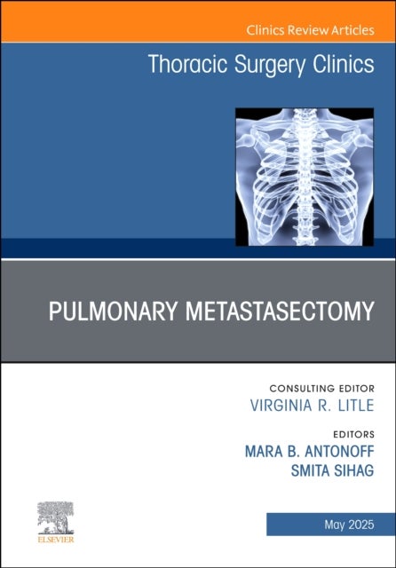 Pulmonary Metastasectomy, An Issue of Thoracic Surgery Clinics