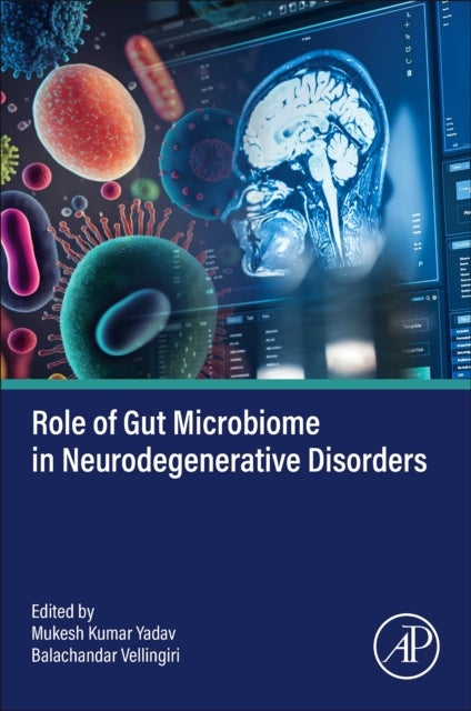 Role of Gut Microbiome in Neurodegenerative  Disorders