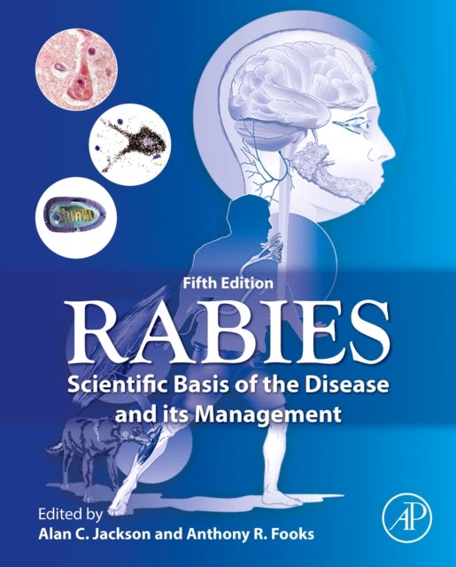 Rabies - Scientific Basis of the Disease and Its Management