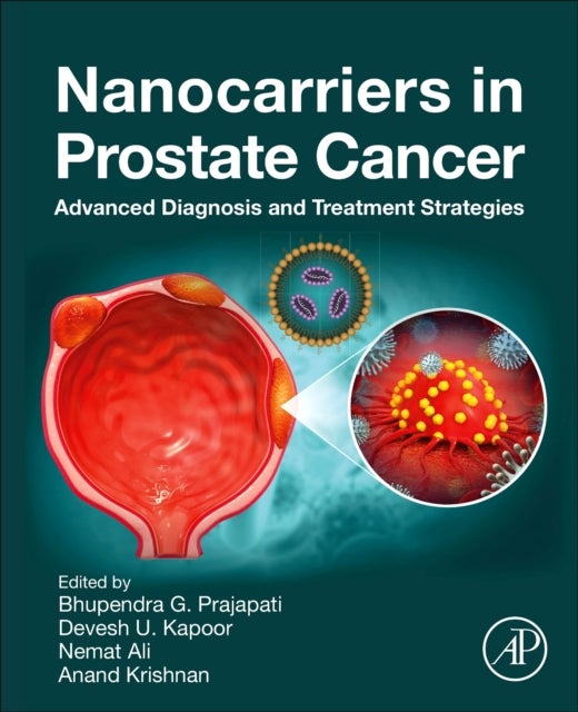 Nanocarriers in Prostate Cancer - Advanced Diagnosis and Treatment Strategies