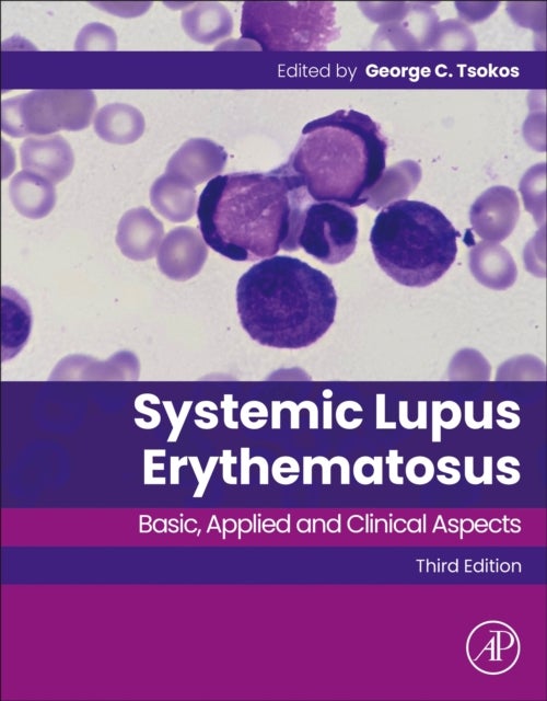 Systemic Lupus Erythematosus - Basic, Applied and Clinical Aspects